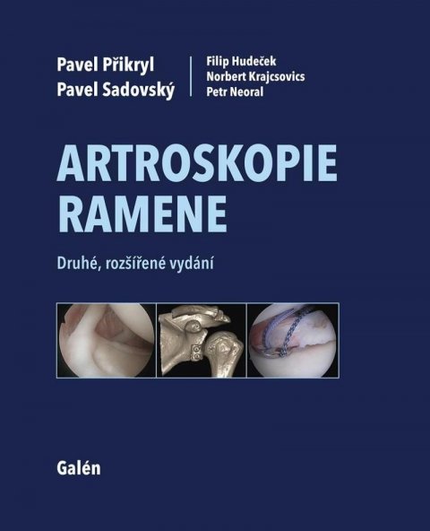 Přikryl Pavel: Artroskopie ramene